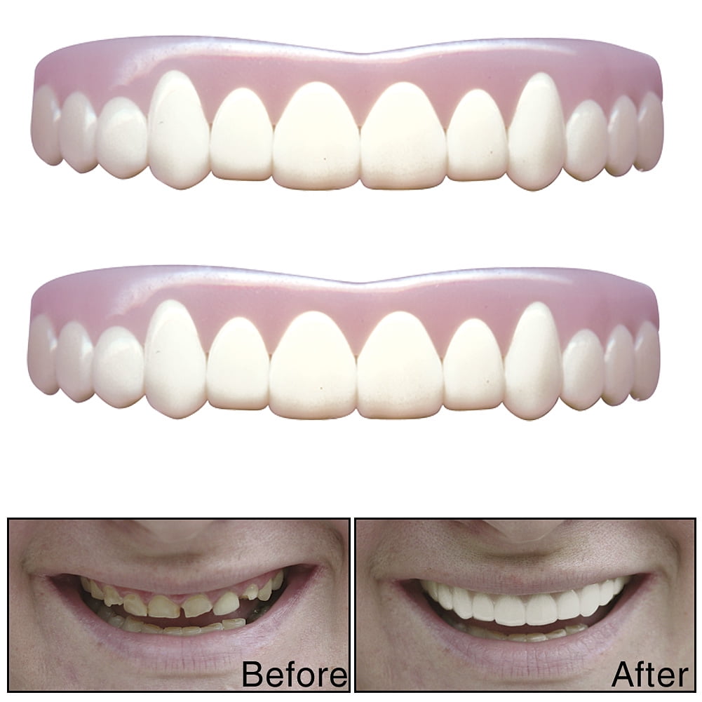 teeth imako smile cosmetic natural walmart confidence bukk dr