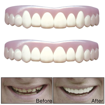 (Set/2) Natural Imako Cosmetic Custom Teeth (Large) - Smile With Confidence