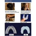 thumbnail image 3 of Anti Snoring Devices/ Snore Stopper/ Sleep Apnea/ Snoring Solution/ Stop Snoring/ Anti Snore Device/ Airing Sleep Apnea Device-Wtake, 3 of 5