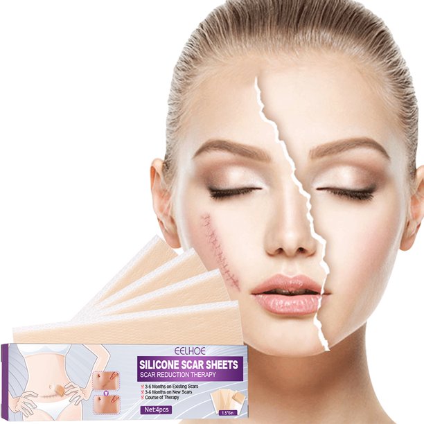 Smrinog 4Pcs Silicone Scar Sheets Gel Strips Tape Patch Reusable Self