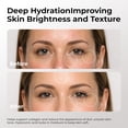 thumbnail image 6 of Skin Deva Vitamin C & Hyaluronic Acid Serum, 1 oz Anti-Aging, Collagen Booster, Dark Spot Corrector, 6 of 10