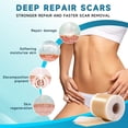 thumbnail image 2 of Silicone Scar Sheets, Silicone Scar Tape(1.6”x 60” Roll-1.5M), Silicone Scar Strips, Professional Scar Removal Sheets for Surgical Scars, Keloid, C-Section, Burn et, 2 of 8
