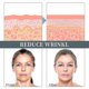 thumbnail image 3 of 2023 New 2pcs Collagen Booster Anti-aging Serum, Collagen Booster Serum, Collagen Booster Cream For Face With Hyal, 3 of 5
