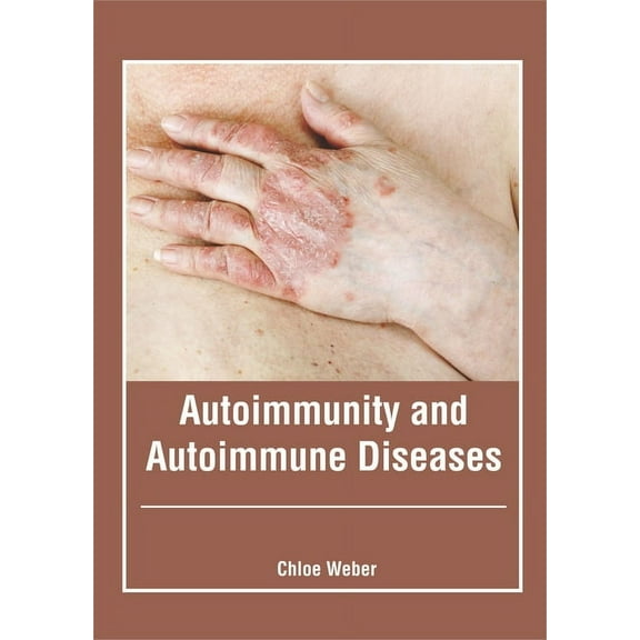 Autoimmunity and Autoimmune Diseases, (Hardcover)