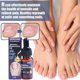 thumbnail image 5 of German Toenailcare Oil For Removing Paronychia, Ingrowing Toenail Treatment Oil‖ E4Q0, 5 of 7