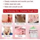 thumbnail image 3 of Foot Cream Anti-freeze, Anti-dry, Moisturizing, Repairing, Dry, Peeling, Rough, Cracked Cream, 3 of 5