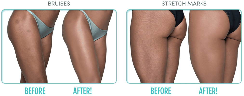 ideal conceal walmart