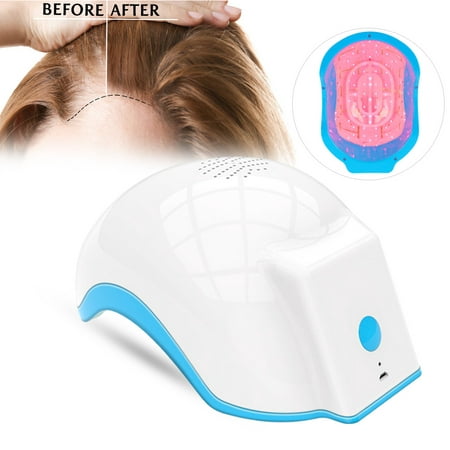 HURRISE 100-240v Hair Loss Regrowth Treatment Therapy Alopecia Cap Helmet, Hair Growth Cap, Therapy Alopecia