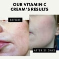 thumbnail image 3 of Hidratante Facial Eclat con Vitamina C Iluminadora 50 ml, 3 of 7