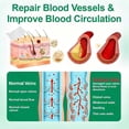 thumbnail image 4 of QARUN 2026 New Leg Varicose Veins Patch,Vein Target Microdarts Patch,Vein Target Patch,Natural Ingredients Leg Treatment for All Skin Types (3Boxes), 4 of 5