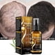 thumbnail image 1 of Biotin hair growth spray anti hair loss fast regeneration scalp treatment essence, 1 of 5