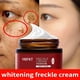 thumbnail image 1 of Crema blanqueadora eficaz para pecas, Gel para eliminar Melasma, pigmento Para manchas de acné, melanina, manchas oscuras, pigmentación, hidratante para el cuidado de la piel"one" Fivean LED, 1 of 2