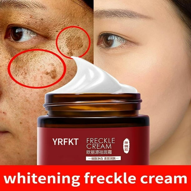 Crema blanqueadora eficaz para pecas, Gel para eliminar Melasma, pigmento Para manchas de acné, melanina, manchas oscuras, pigmentación, hidratante para el cuidado de la piel"one" Fivean LED