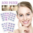 thumbnail image 4 of 12 Pieces Acne removal Patch Tag Hydrocolloid Pimple Patch Acne Spot V2M4, 4 of 8