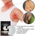 thumbnail image 1 of Pegatinas linfáticas South Moon para el cuerpo y el cuello, pegatinas reparadoras linfáticas para el cuidado de la columna cervical reafirmante_x | |, 1 of 5