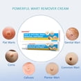 thumbnail image 4 of Crema eliminadora de verrugas WEIRBIU con ácido salicílico 30 ml, 4 of 7