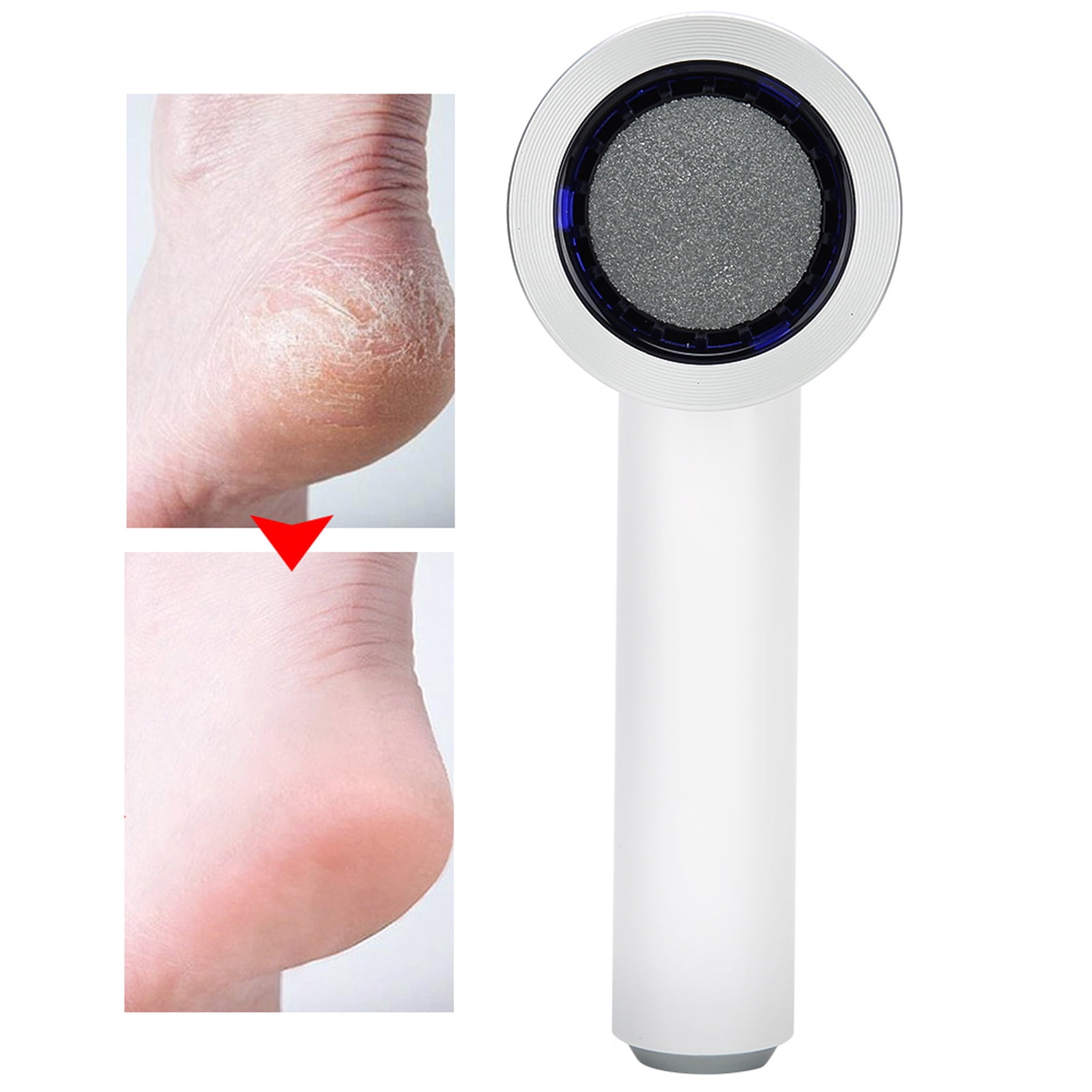 Strong Endurance Electric Pedicure Tool, Electric Foot File, For Dead Hard Cracked Dry Skin