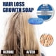 thumbnail image 3 of Ginger Shampoo Soap Promote Hair Growth Natural Plant Anti Dandruff Itching Prevent Hair Loss Scalp Treatment Hair Shampoo Bar, 3 of 5