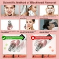 thumbnail image 2 of Lilian&Gema Blackhead Remover Vacuum, Rechargeable Electric Facial Pore Cleaner with 3 Suction Power & 5 Probes, Blackhead Acne Extractor Kit for Men and Women, 2 of 7
