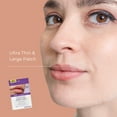 thumbnail image 3 of Cold Sore Treatment Patch Duo - Large Ultra Thin 15mm & Original Thin 12mm 60 Patches, 3 of 14