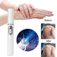 thumbnail image 1 of Nail Fungus Blue Light Laser Pointer, Painless Manicure For Onychomycosis Armor, 1 of 3