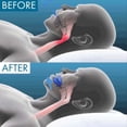 thumbnail image 2 of Honex Mouthpiece for Sleep Universal Size for Men (1 Set), mouth guard for grinding teeth at night, 2 of 5