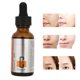 thumbnail image 5 of Suero de vitamina C ANGGREK ISNER MILE antienvejecimiento 30ml, 5 of 8
