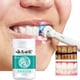 thumbnail image 5 of Fiudx Whitening Dental, Natural Bucals And Perlada Natural, Alienating Fresco, Quittamanchas Seguro, Esmalte Dental, Sonrisa Radiante, Bucal Diario para Familias, Rutina de Cepillado Suave, Fórmula Y, 5 of 7