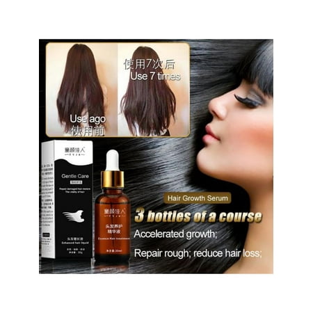 Hair Growth Essence Hair Loss Liquid 30ml Dense Hair Fast Sunburst Hair Growth Grow Restoration
