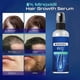 thumbnail image 4 of Spray para el crecimiento del cabello con 6% Minoxidil, spray para el tratamiento del crecimiento del cabello con Minoxidil para un crecimiento del cabello más fuerte, más grueso y más largo, 4 of 5