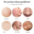 thumbnail image 5 of MOOYAM Anti-Aging Anti-wrinkles Pore Replenish Moisturizings Skin Elasticity Refining Facials Essence Essential Liquids for Home Daily Salon Use, 5 of 5