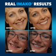 thumbnail image 4 of Imako Cosmetic Teeth Novelty Smile Overlay. Uppers Only. Small Natural 2 Pack, 4 of 6
