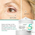 thumbnail image 2 of Eye Creams for Anti-Aging - 5 Seconds Instant Effect, Anti Aging Fade Wrinkle Fast Absorption Expertise Wrinkle Remover Cream Face Essence Cream, 1oz, 2 of 10