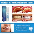 thumbnail image 5 of Dentizen Gum Therapy Gel, Teeth Whitening Essence Pen, Teeth Whitening Pen, 5 of 5