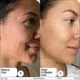 thumbnail image 4 of Sérum Youth To The People Retinal + Niacinamida 30 ml, 4 of 9