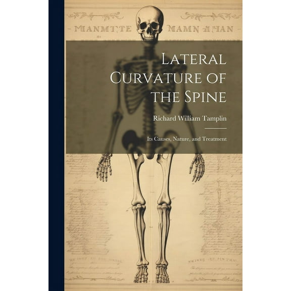 Lateral Curvature of the Spine: Its Causes, Nature, and Treatment