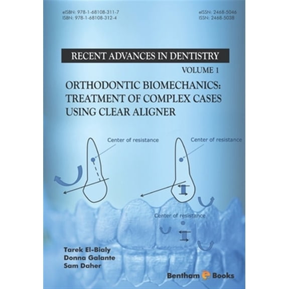 Pre-Owned Orthodontic Biomechanics: Treatment Of Complex Cases Using Clear Aligner