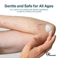 thumbnail image 4 of Dermveda Ultra Bite Itch Relief Cream, Natural Anti-Itch Cream for Hives, Bites & Minor Cuts, 2 fl oz, 4 of 8
