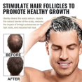 thumbnail image 3 of 1-3pcs Root Activator Shampoo, SPARTAN Hair Loss Shampoo,Shampoo Root Activator, 3 of 5
