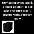 thumbnail image 5 of (Pack of 1) Back2Naturalness African Black Soap Bar Eucalyptus +  Peppermint For All Skin Types Cleanser with Shea Butter 4 oz, 5 of 14