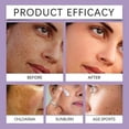thumbnail image 5 of Anti Aging Retinol Cream Advanced Anti-Hyperpigmentation Cream 2025, 5 of 5