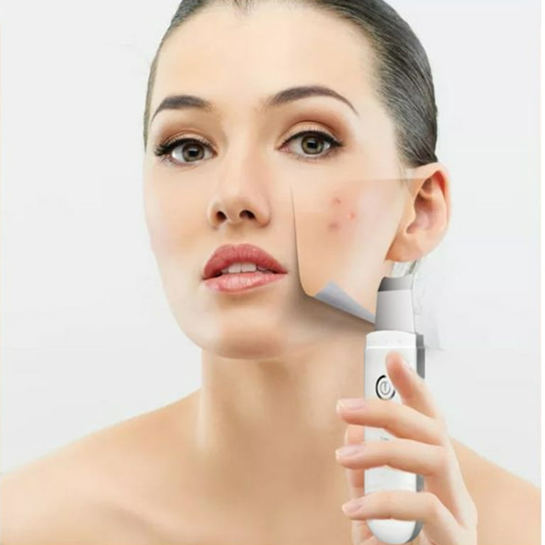 Facial Ultrasonic Skin Scrubber Face Spatulablackhead Remover For Face With  6 Modes, Dead Skin Remover Facial Scrubber Spatula, Blackhead Extractor Fa