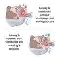 thumbnail image 3 of Adjustable Mouth With Silicone Anti-snoring Device, 3 of 3