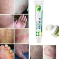 CENGZISHU Disposable Pumice Stone for Feet Itching Cream Herbal 20g
