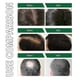 thumbnail image 4 of OUHOE Hair Growth Spray Repairs Hair Follicle Damage, Dry and Frizzy Hair, Thickens and Prevents Hair Lo, 4 of 4