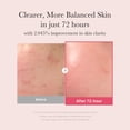 thumbnail image 3 of Sérum facial medicube TXA+Niacinamida 15% Glow 30 ml, 3 of 8