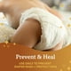 thumbnail image 4 of Pomada para dermatitis del pañal A+D Original previene y trata 120 ml, 4 of 6
