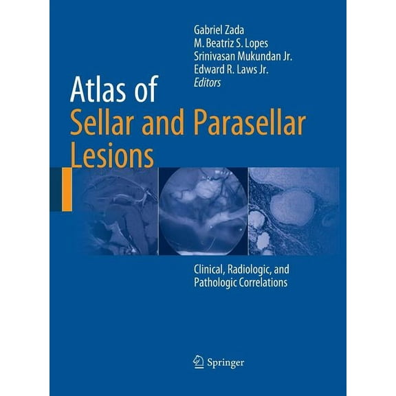 Atlas of Sellar and Parasellar Lesions: Clinical, Radiologic, and Pathologic Correlations, (Paperback)
