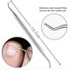 thumbnail image 4 of Ingrown toenail set, high quality stainless steel manicure set for nail problems, thick nails and, 4 of 4