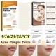 thumbnail image 2 of 5-28pcs Acne Patch Repair Blemish Pimple Remover Tool for Face Chin Forehead Breathable, 2 of 5
